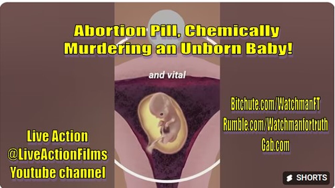 The Abortion Pill Has Killed Over 5.6 Million Babies In America. Time To ban It. #prolife #truth