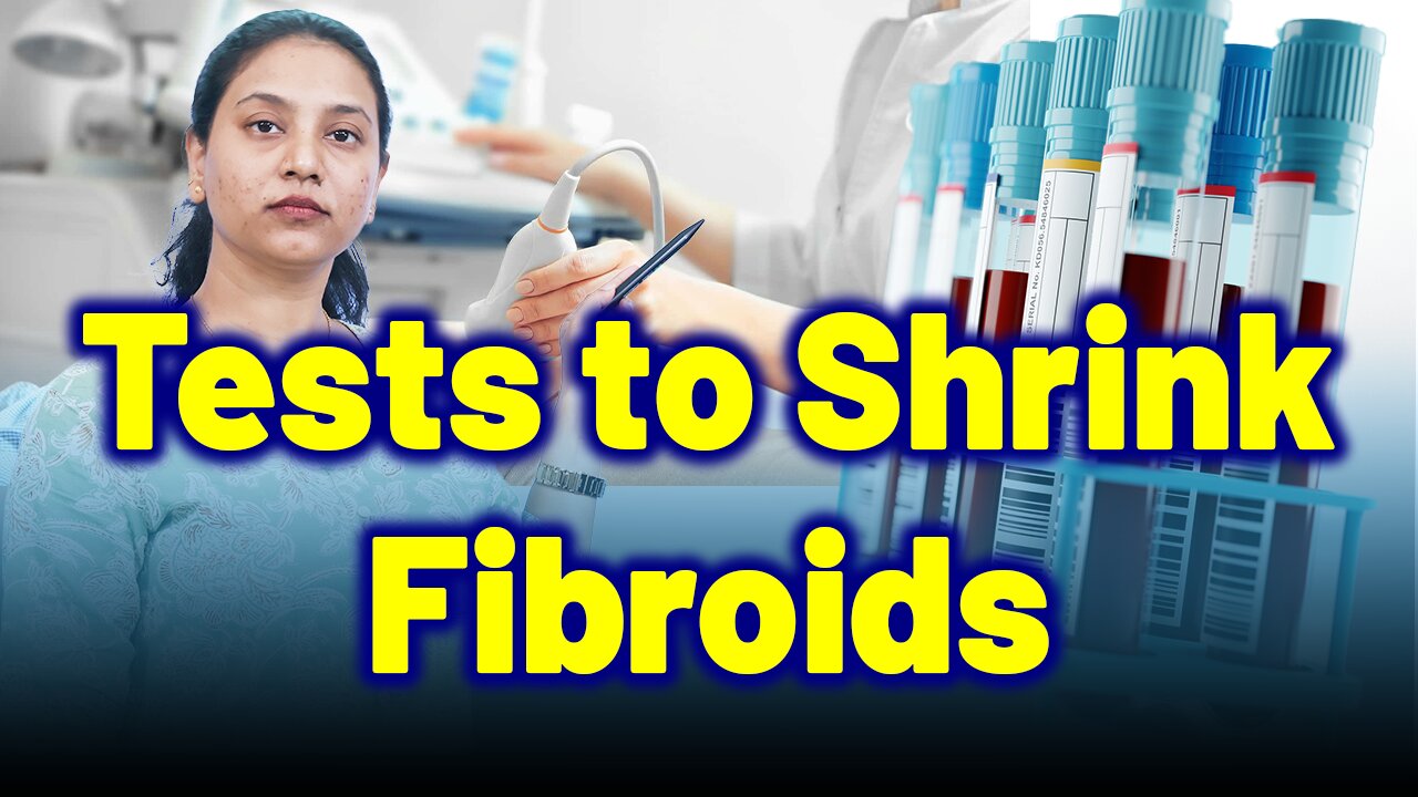 Tests Before Myolysis,Laparoscopic,Cryomyolysis,Ultrasound for Shrinking Fibroids.| Treatment & Cure