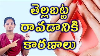 తెల్లబట్ట రావడానికి కారణాలు Risk Factors & Causes For White Discharge Homeopathy Treatment Medicine
