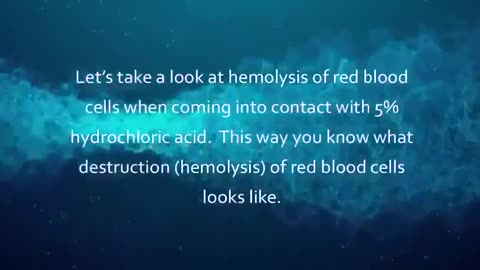 CI02-Chlorine Dioxide aka MMS/CDS The Benefit when used to treat Disorders of Blood Viscosity