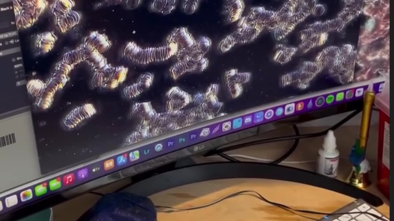 They were diagnosed with early Alzheimer’s… But the root cause. Spike protein