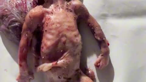 A fetus emerged from the womb of his martyred mother, not yet born into life (Graphic)