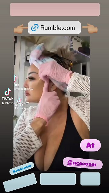 Adding Volume structure in the cheek area using PDO threads