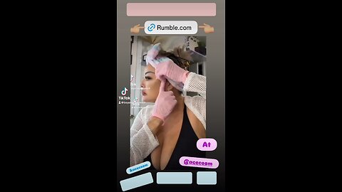 Adding Volume structure in the cheek area using PDO threads