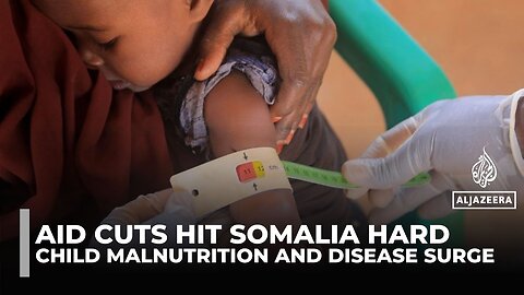 US aid cuts leave Somali children at risk as malnutrition and disease surge