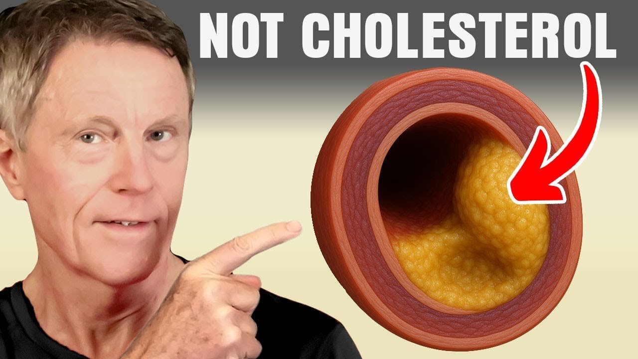High Cholesterol DOES NOT Clog arteries (if you are doing THIS)