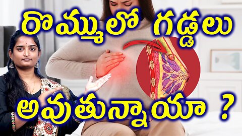 రొమ్ములో గడ్డలు అవుతున్నాయా? Are You Developing Lumps in the Breast? Fibroadenoma Homeopathy Cure