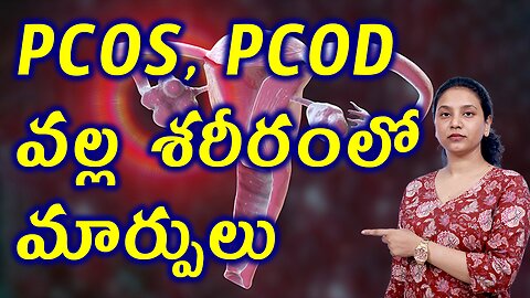 PCOS PCOD వల్ల శరీరంలో మార్పులు PCOS PCOD Effect on Women Body Best Homeopathy Treatment Cure Clinic