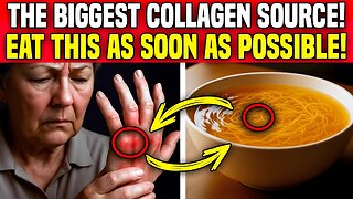 Ditch Discomfort: 8 Collagen-Boosting Foods to Revitalize Joints and Legs! LE56