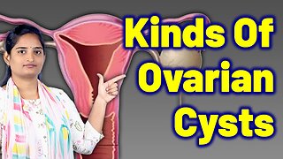 What Are The Types Of Ovarian Cyst, Follicular Cyst, Corpus Luteum Cyst | Treatment Cure Gynaecology