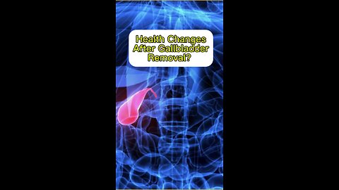 Gallbladder Removed? Here’s what can happen!
