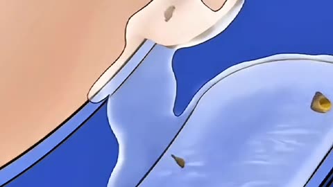 Blocked Ear Cleaning Procedure, Safe Medical Treatment Explained