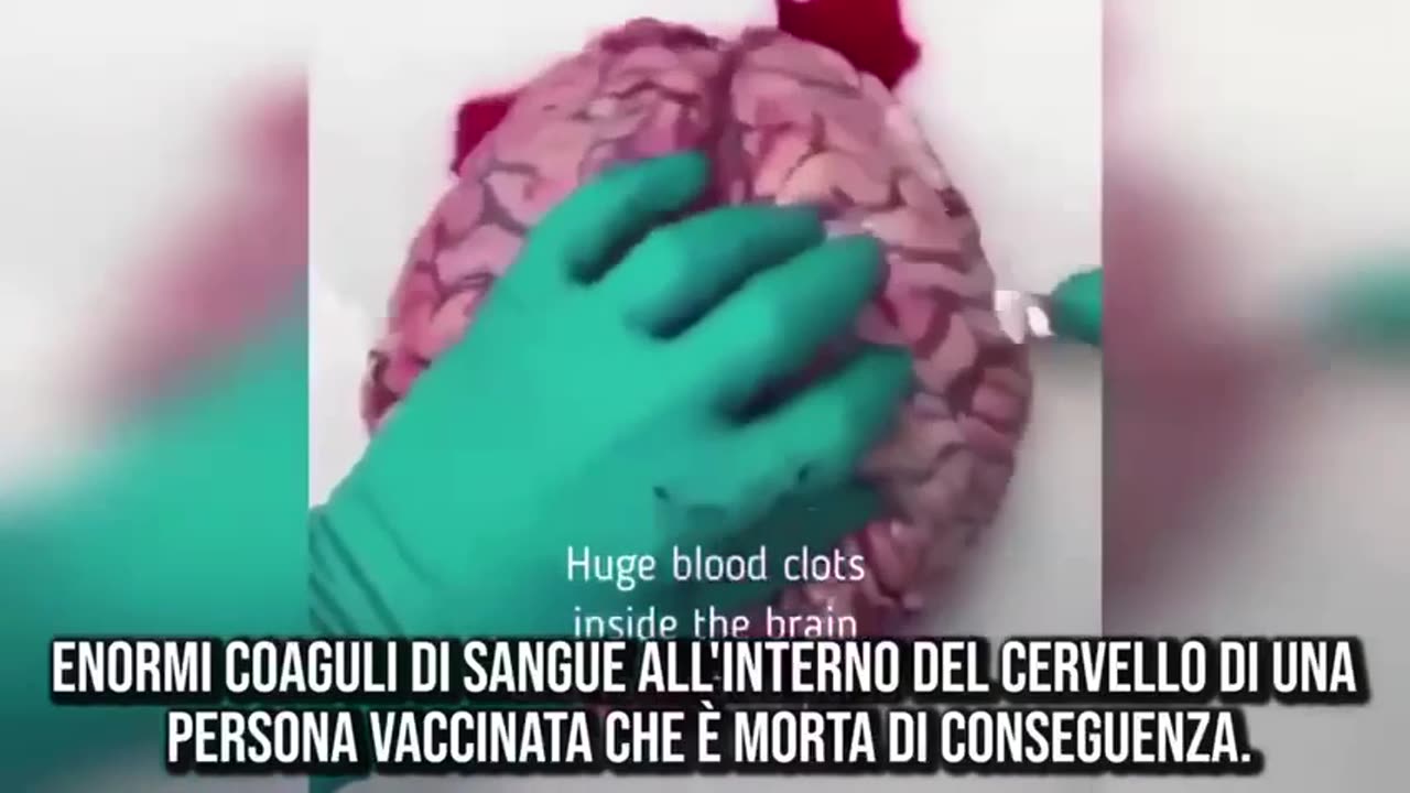 ECCO GLI ORRORI DEI SIERI DICHIARATI "SICURI ED EFFICACI"