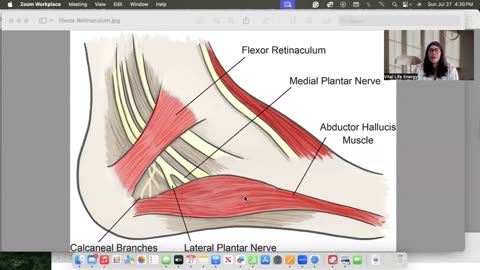 Ask in your heart to be free