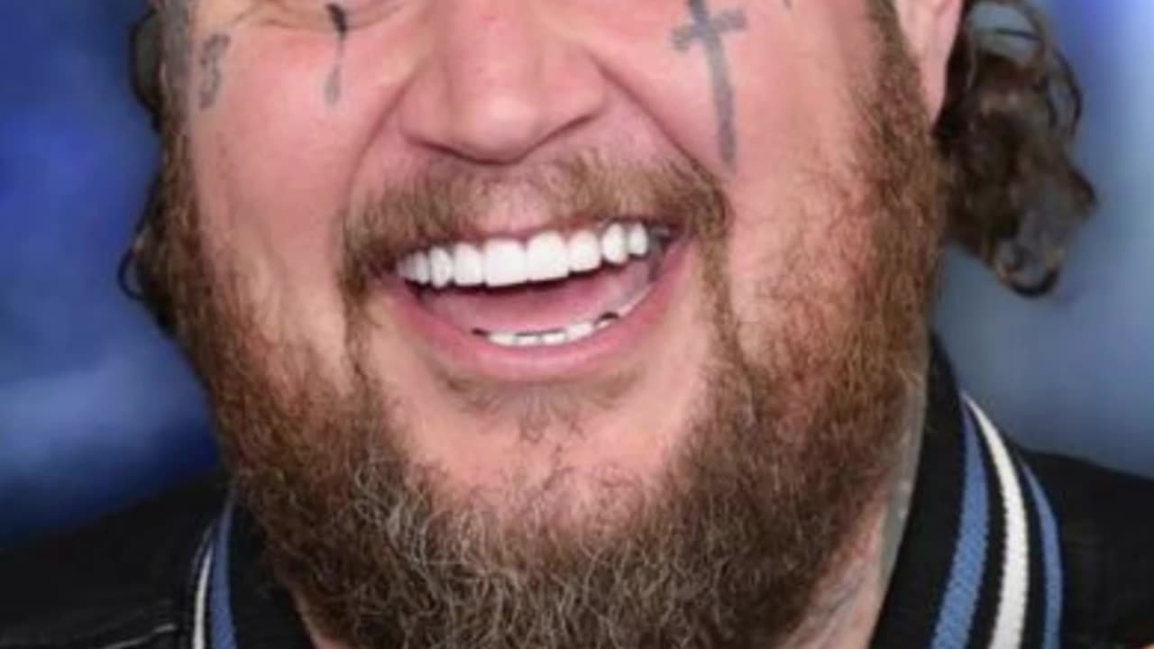 Post Malone Praises Jelly Roll While Energizing Fans on Europe Tour 2025 - WorldEye