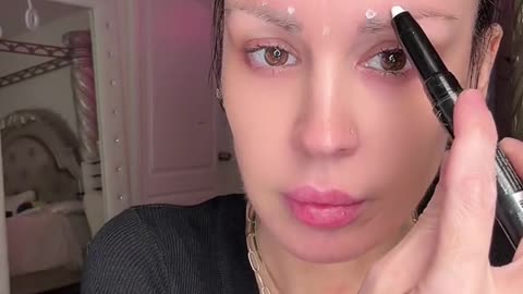 Botox touch up mapping CELMADE.CO use code: JAMIE
