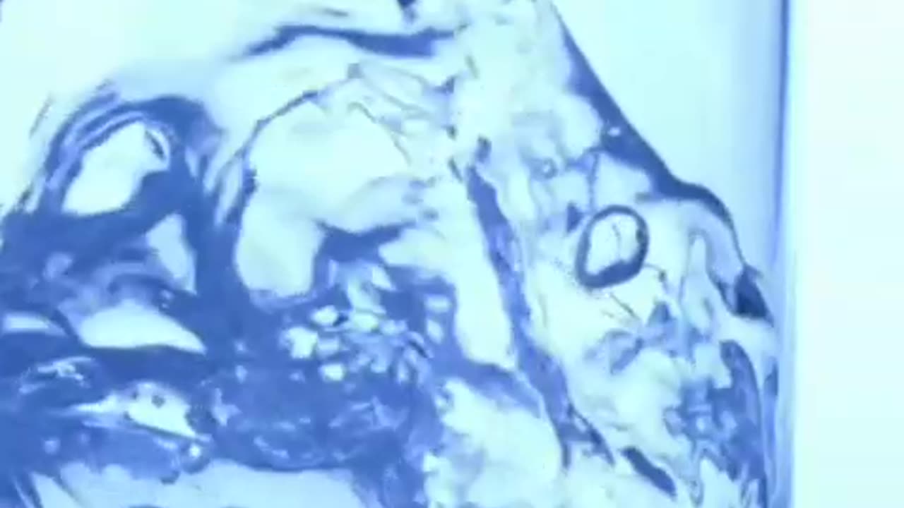 Start Your Day Right: Drink Warm Water on an Empty Stomach 🌞💧