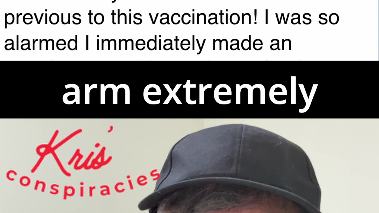 Woman Goes Bald After Vaccine