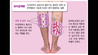 197. 뮨제는 스파이크 단백질이다.