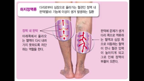 197. 뮨제는 스파이크 단백질이다.