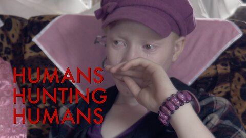 Humans Hunting Humans - The Murder of Albinos in Tanzania