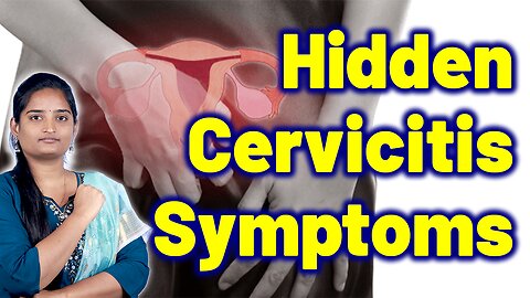 Symptoms Of Cervicitis, Cervicitis Uteri, Cervical Mucosal | Treatment Cure Medicine | Gynaecology