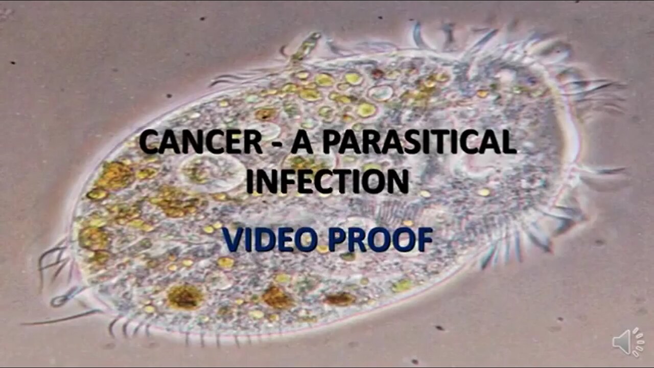 Cancer Is Caused By Parasites