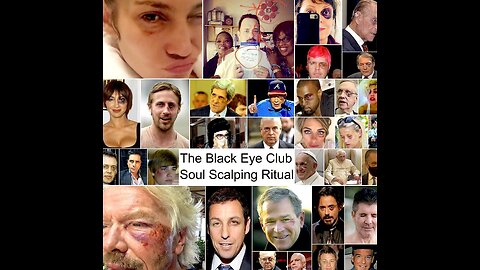 THE BLACK EYE CLUB Is Elon Musk the Newest Member