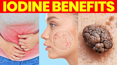 The Benefits of Iodine - Side-Effects and More