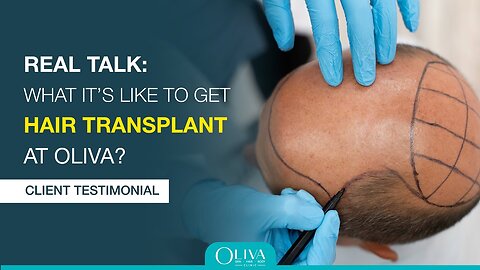 From Hair Loss to Confidence – Hair Transplant Journey