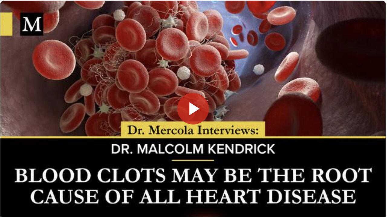 Blood Clots May Be the Root Cause of All Heart Disease - Interview with Dr. Malcolm Kendrick