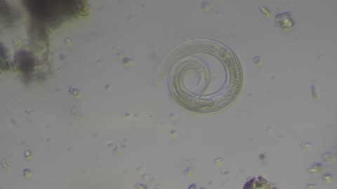 Large Nematode
