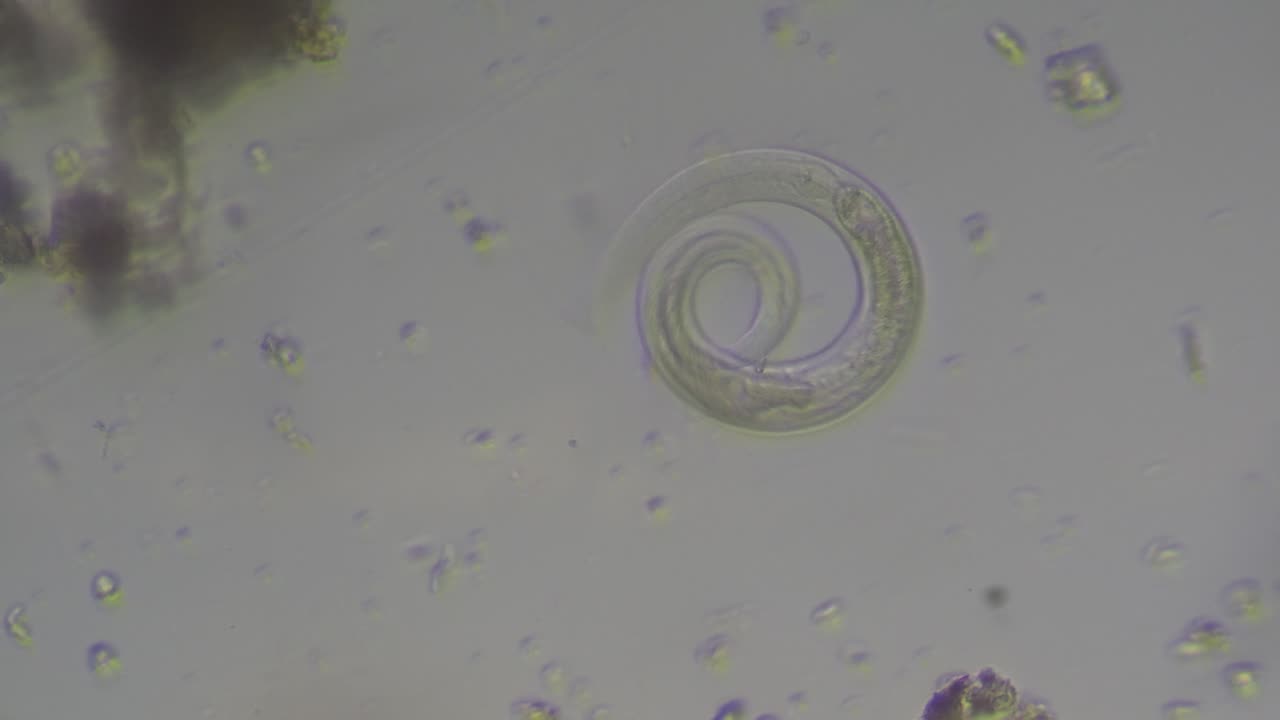 Large Nematode