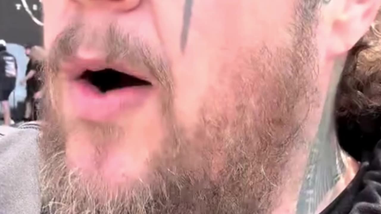 Jelly Roll Opens Up About His Nickname and Mental Health Journey - WorldEye