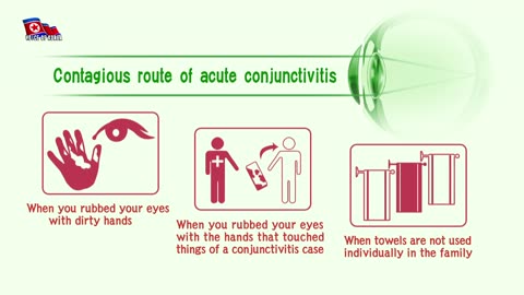 Prevention and Treatment of Acute Conjunctivitis