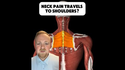 Neck pain and shoulder pain relief with upper cervical chiropractor | Neckwise
