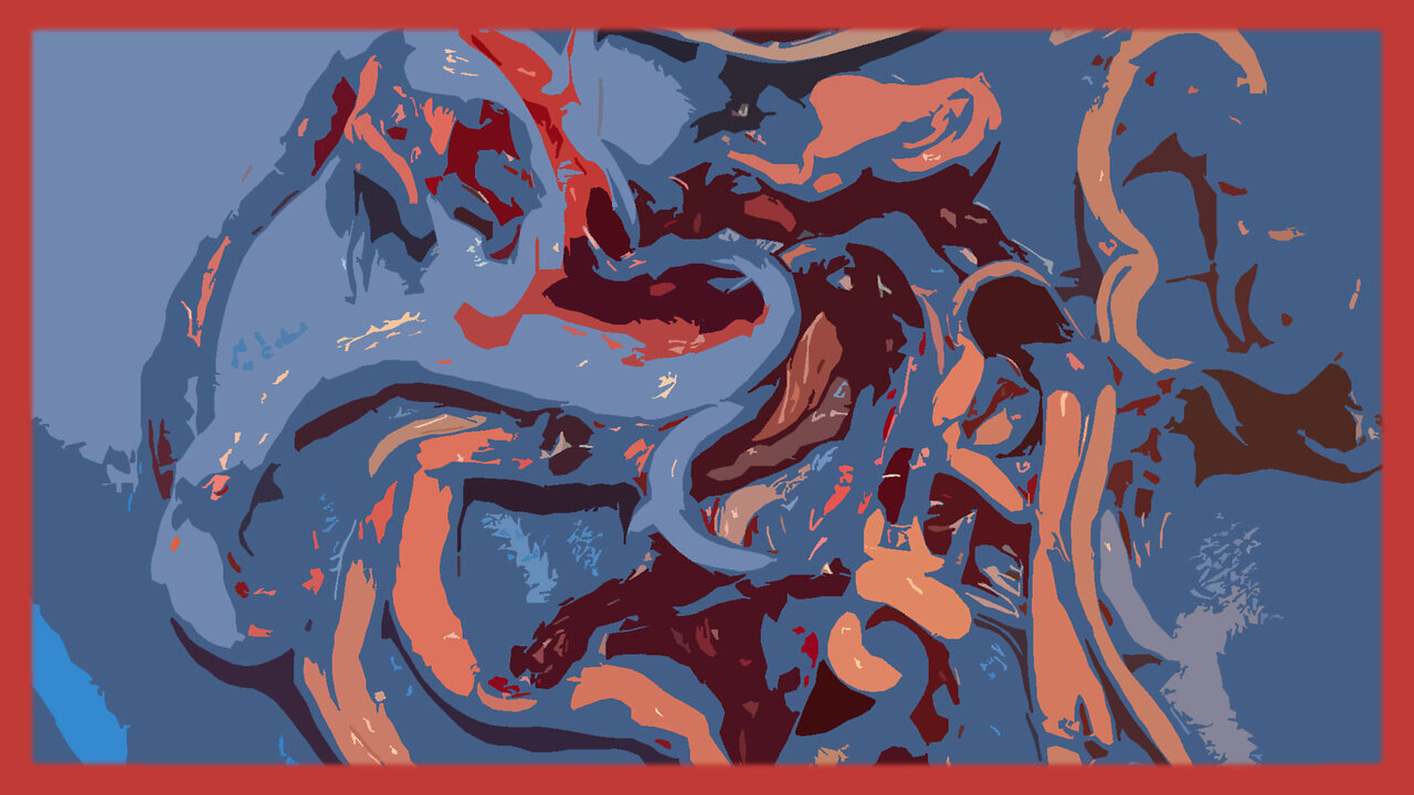 70% Of Tennessee Embalmers Are Still Seeing Death By The Clot Shot! Greg, Reese Report 🎯SEE DESC🎯