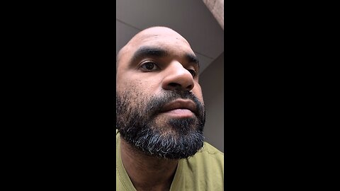 37-Year-Old with baby blue hair dye.