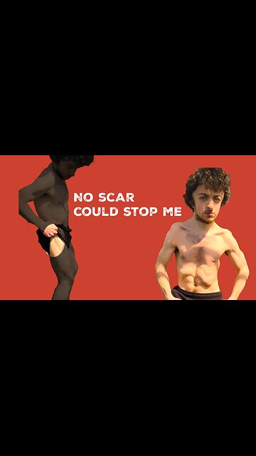 Revealing the Scars That Made Me Unstoppable