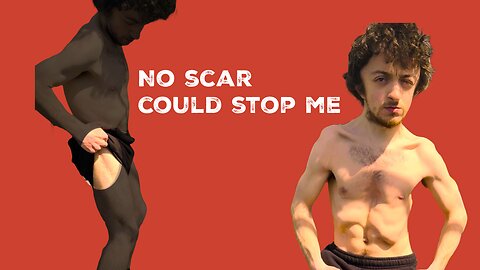 Revealing the Scars That Made Me Unstoppable