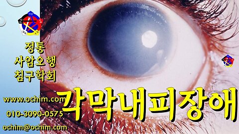 각막내피장애 치료 방법 - 사암오행침, 사암침법, 오행침, 정통사암침
