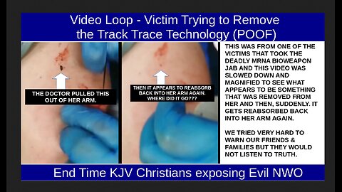Video Loop - Victim Trying to Remove the Track Trace Technology (POOF)