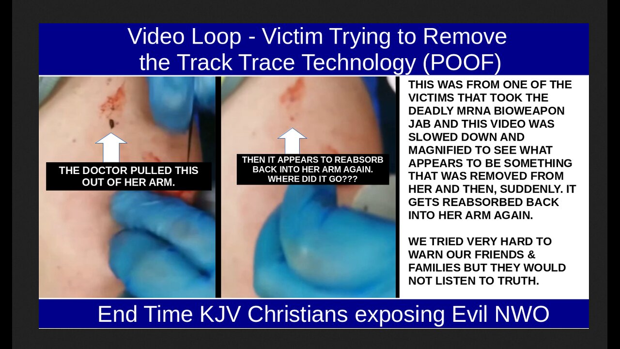 Video Loop - Victim Trying to Remove the Track Trace Technology (POOF)