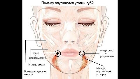 How to lift the corners of the lips? Two exercises.