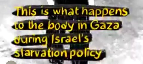 JEWISH STARVATION TACTICS HAVE BEEN USED THROUGHOUT TIME ☠️