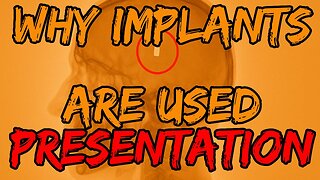 Why Implants Are Used To Hurt People W/ Directed Energy Weapons Live Call #4