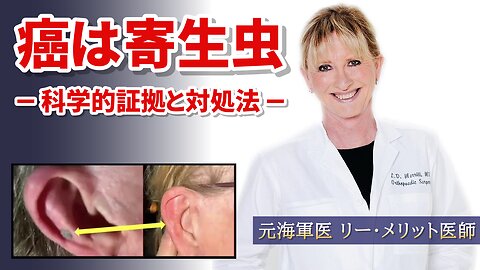 癌は寄生虫 科学的証拠と対処法 リー・メリット医師 Cancer is Parasites Dr Lee Merritt 2025/04/04