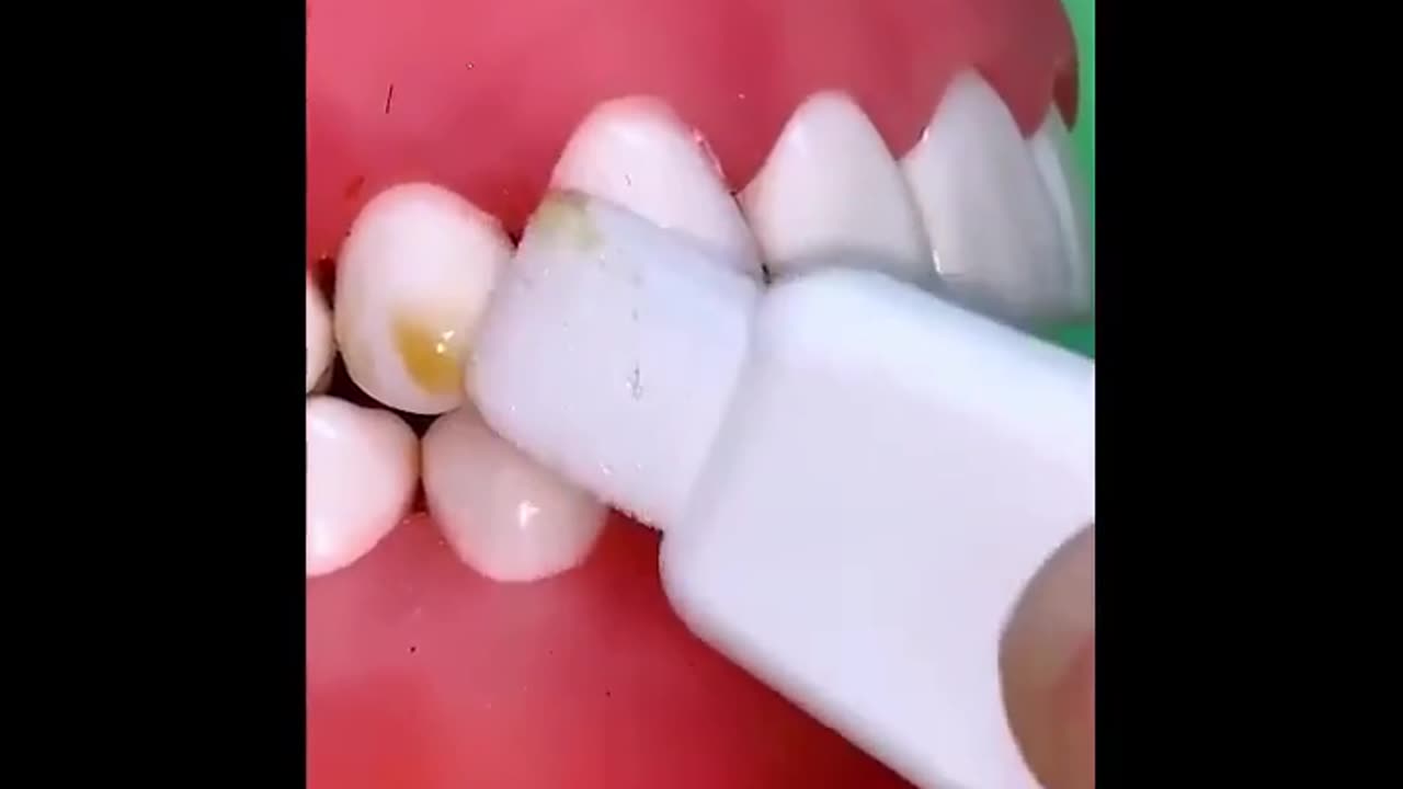 Can you really clean teeth stains with a sponge?