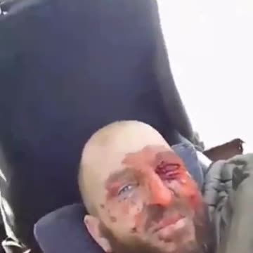 Wounded Russian Soldier Happy to Be Leaving the Front