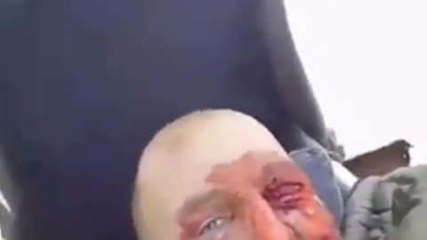 Wounded Russian Soldier Happy to Be Leaving the Front